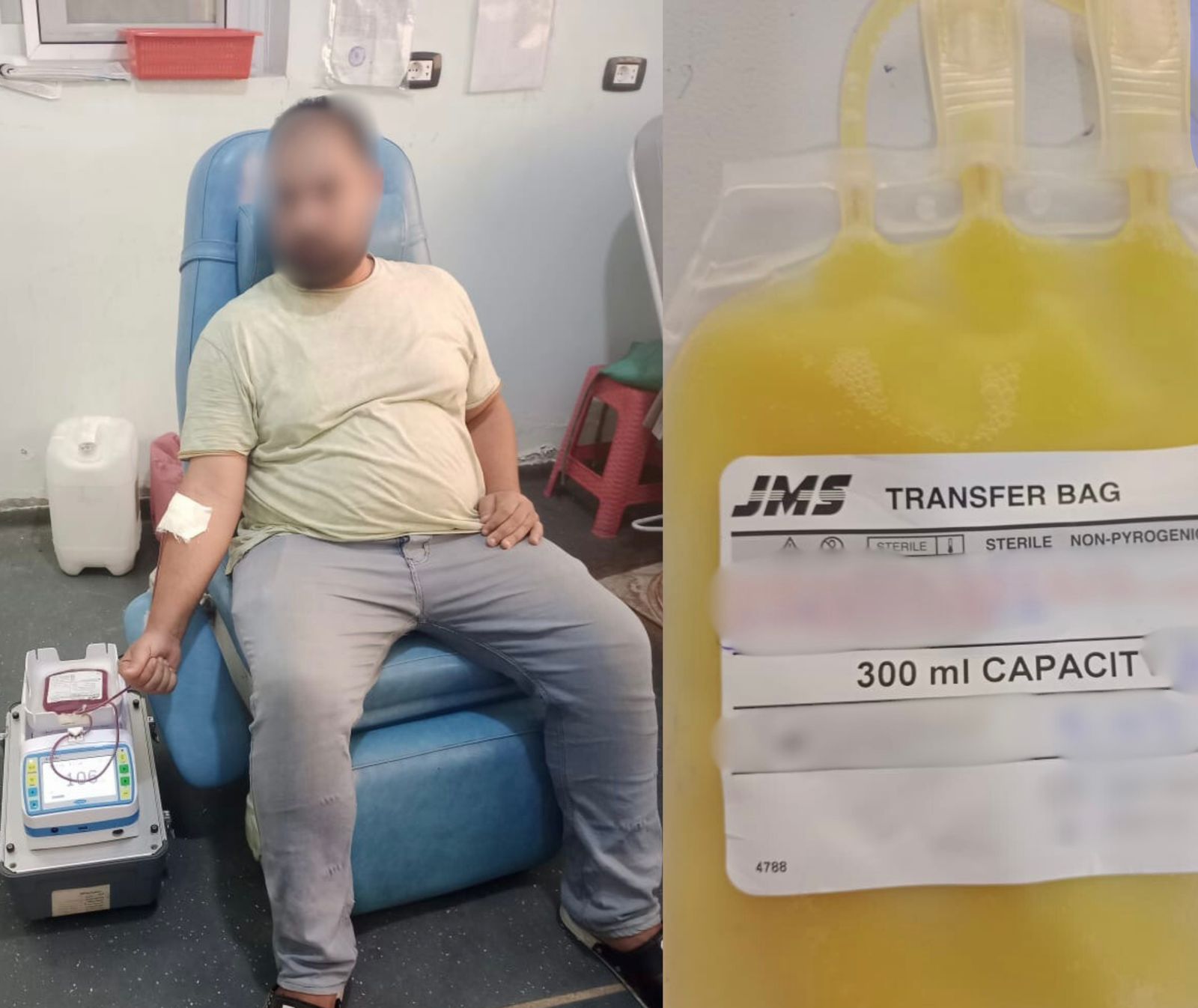 أبو السعد بدء خدمة فصل الصفائح الدموية بمستشفى دسوق العام